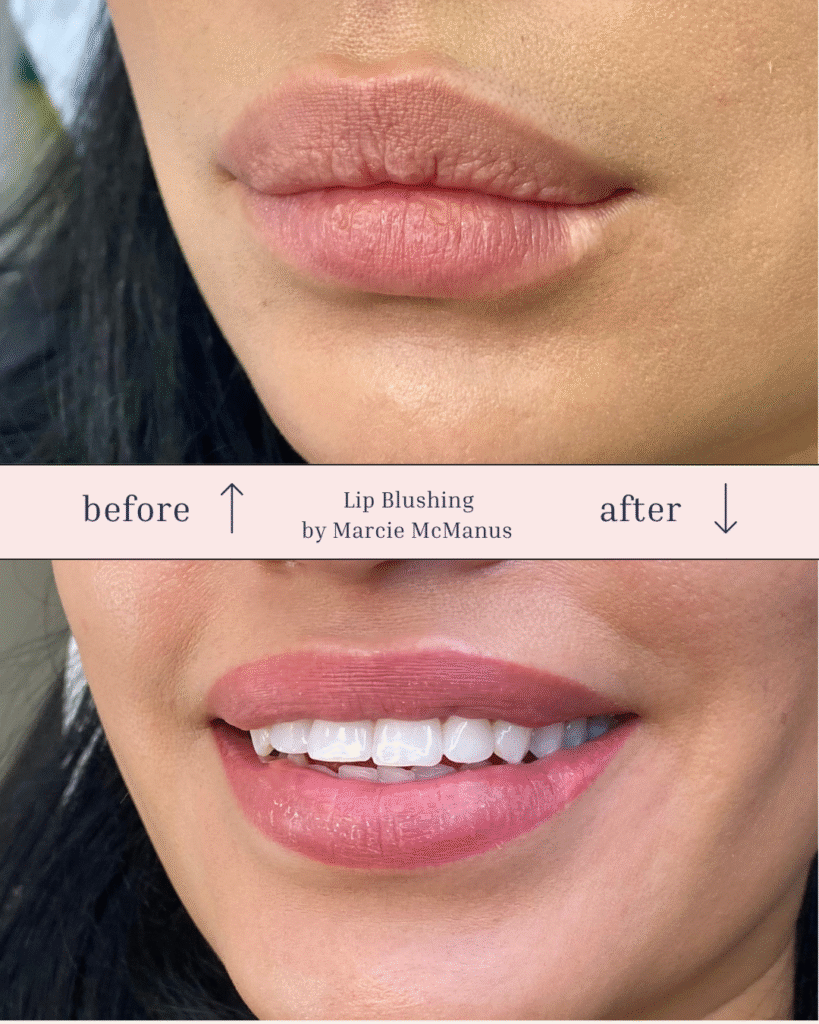 Before and after photo of lip blushing showing healed results with soft colour and scar coverage